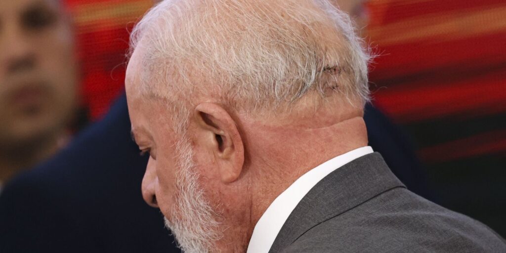 Lula repete exames de imagem da cabeça e quadro é estável